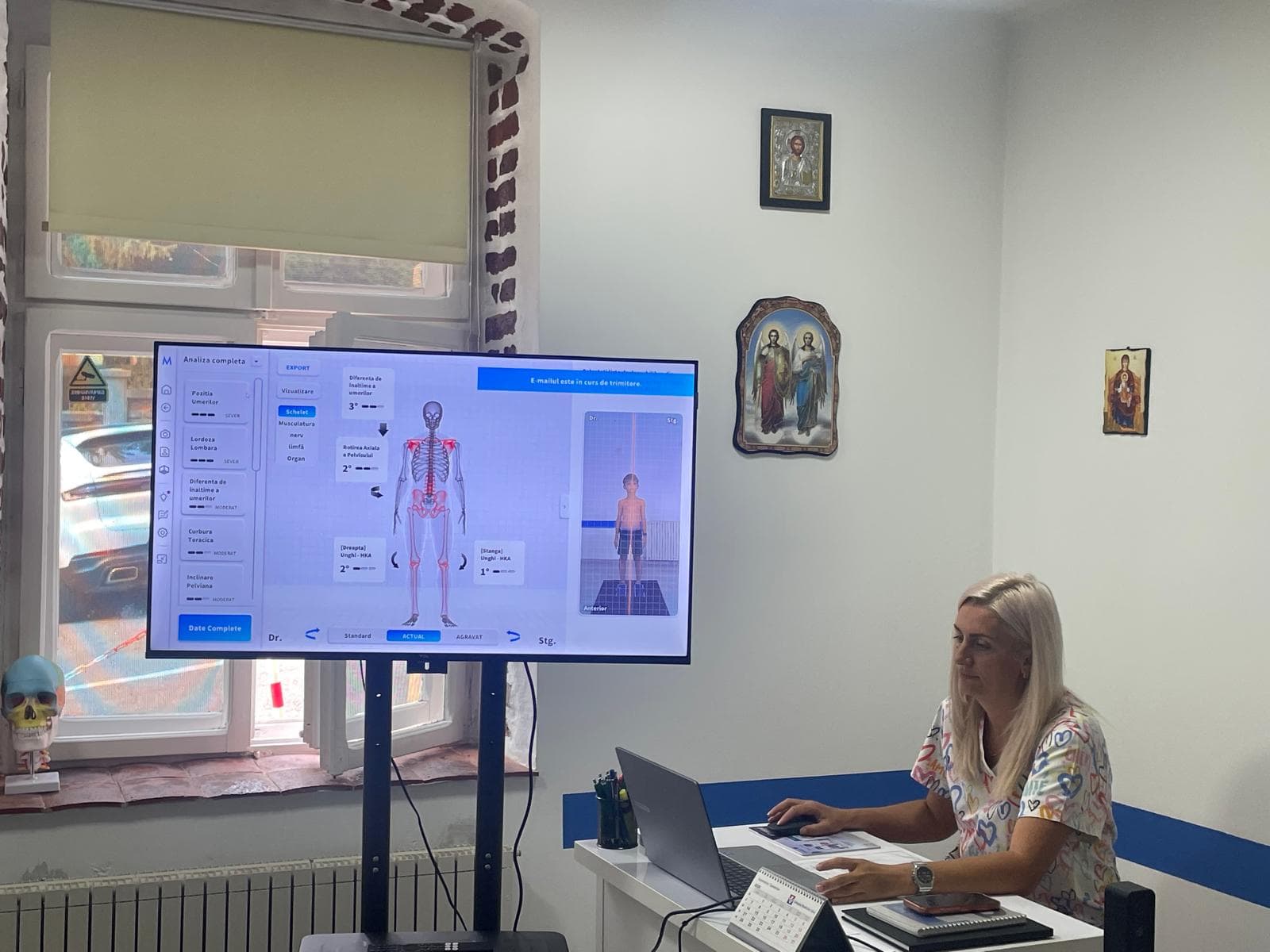 Rezultatul scanării vertebrale 3D pe ecran: coloana și bazinul, cu unghiurile măsurate