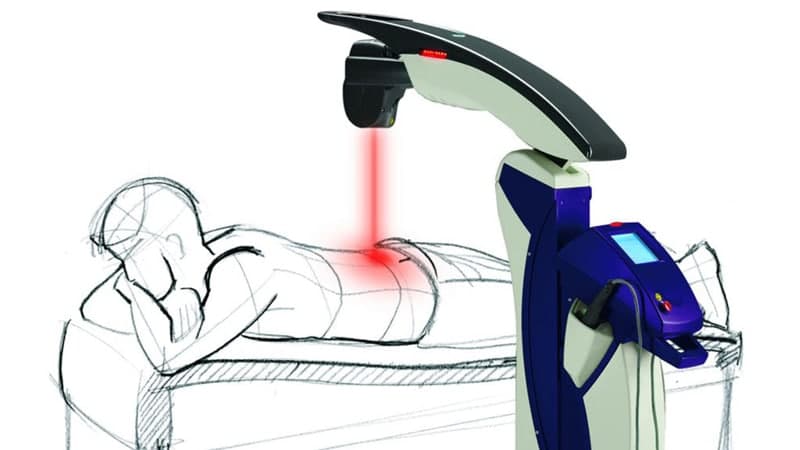 Aparat de terapie laser MLS folosit într-o ședință de fizioterapie