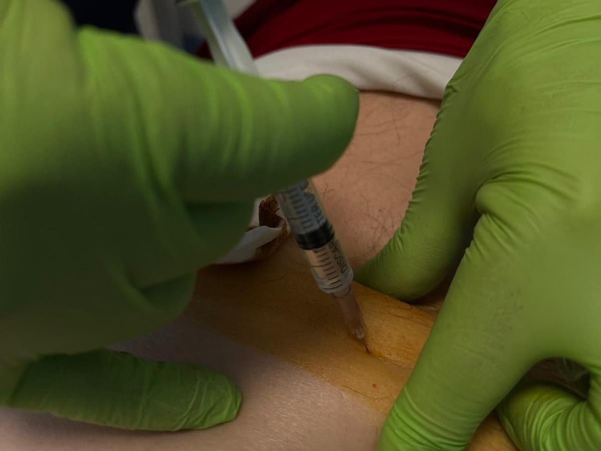 Mâini în mănuși medicale administrează o injecție, pe pielea dezinfectată